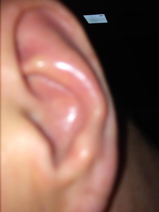R_Klewitz_Ear